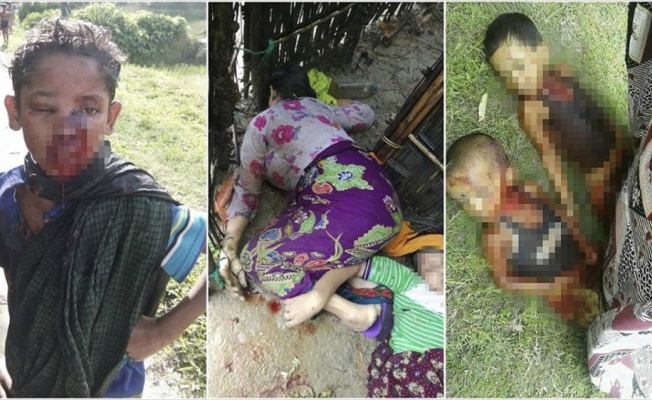 ERC Sözcüsü Dr. Schug: Arakan'da 3 günde 2 ila 3 bin arası Müslüman katledildi