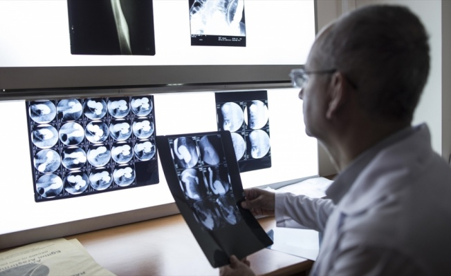 Renkli ve 3 boyutlu röntgen ilk kez insan üzerinde denendi