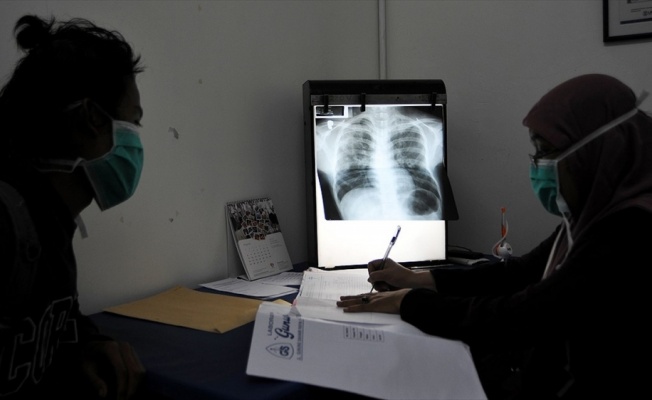 Dünyada her gün yaklaşık 4 bin 500 kişi veremden ölüyor