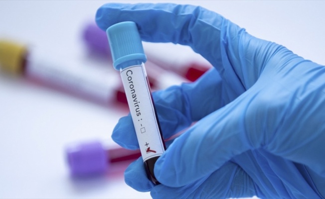 İletişim Başkanlığı dünya genelindeki koronavirüs vaka durumunu açıkladı