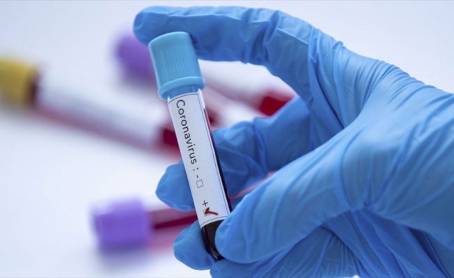 Kuveyt'te yeni tip koronavirüs vakası 56'ya yükseldi