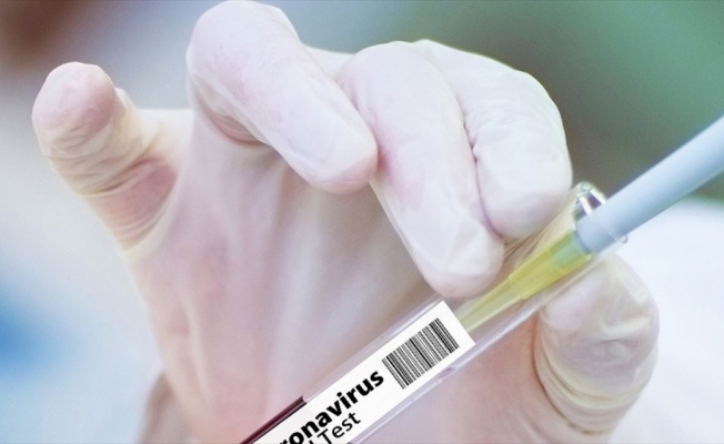 Kovid-19'a karşı yeni aşı adayının klinik denemelerine başlandı