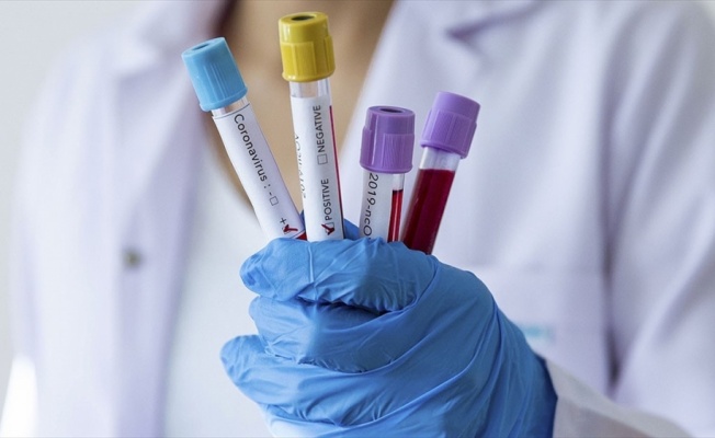 Almanya'da riskli ülkelerden dönüşlerde Kovid-19 testi zorunluluğu cumartesi günü başlıyor