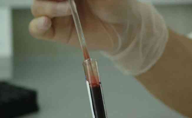 Koronavirüs sürecinde kronik rahatsızlığı bulunanların tedavilerini ertelememesi gerekiyor