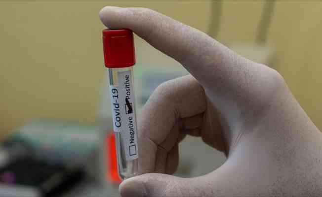 Araştırma: Kovid-19’u hafif atlatan 10 kişiden 1’inde hastalığın etkisi uzun sürüyor