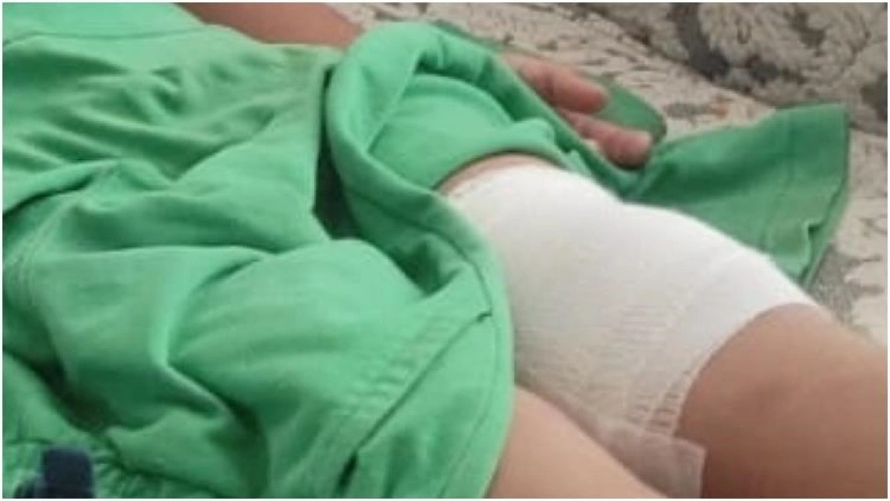 Bursa'da köpeğin saldırdığı çocuk, bacağından yaralandı