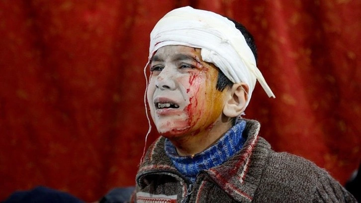 Dünyada misket bombalarından zarar görenlerin yarıya yakını çocuk
