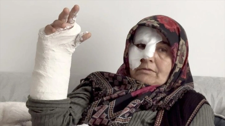 Erzurum'da sahipsiz köpeklerin saldırısında merdivenden düşen kadının kolu ve burnu kırıldı