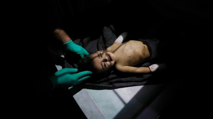 Fransız anestezi uzmanı: Gazze'de çocuklar ameliyathaneye ulaşamadan ölüyor