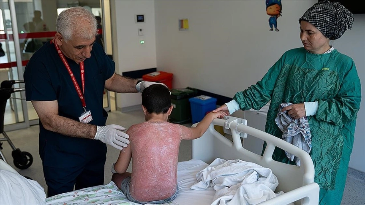 Güneşte 4 saat kalan çocuk, ikinci derece yanıkla hastanelik oldu