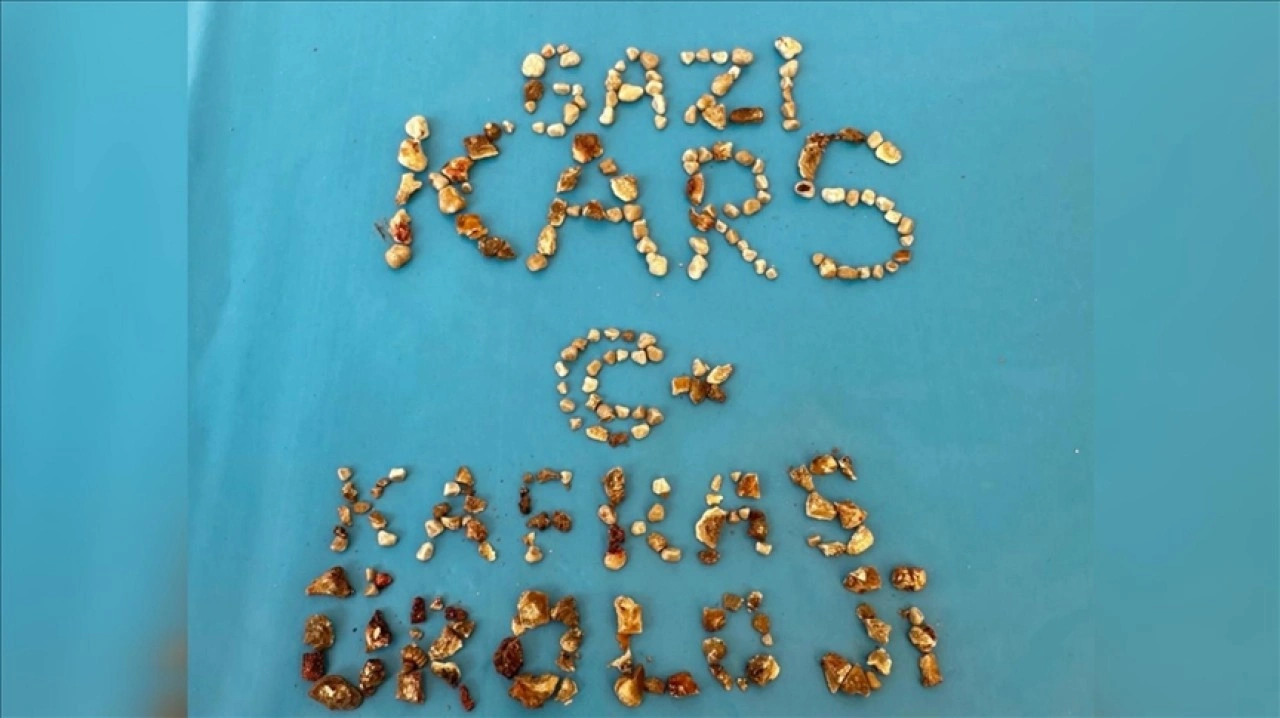 Hastanın iki böbreğinden 300'ün üzerinde taş çıktı