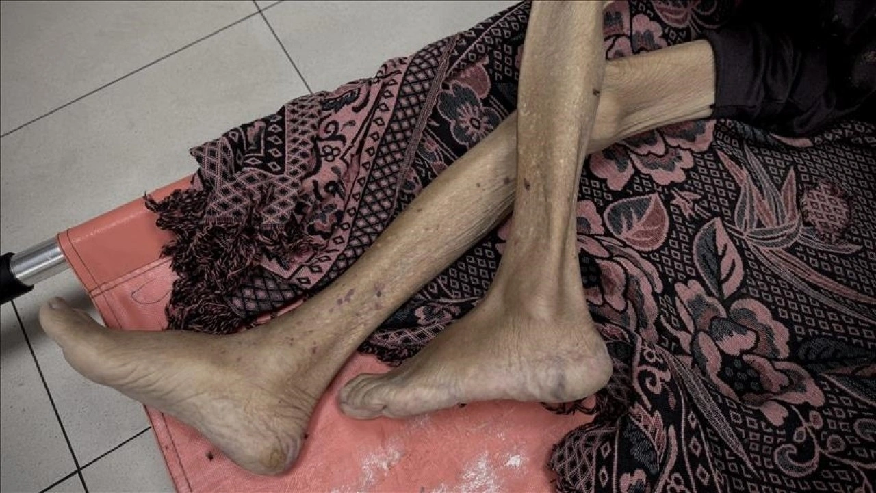İsrail'in kıtlığı dayattığı Gazze'de 3'ü çocuk 10 kişi daha açlıktan hayatını kaybett