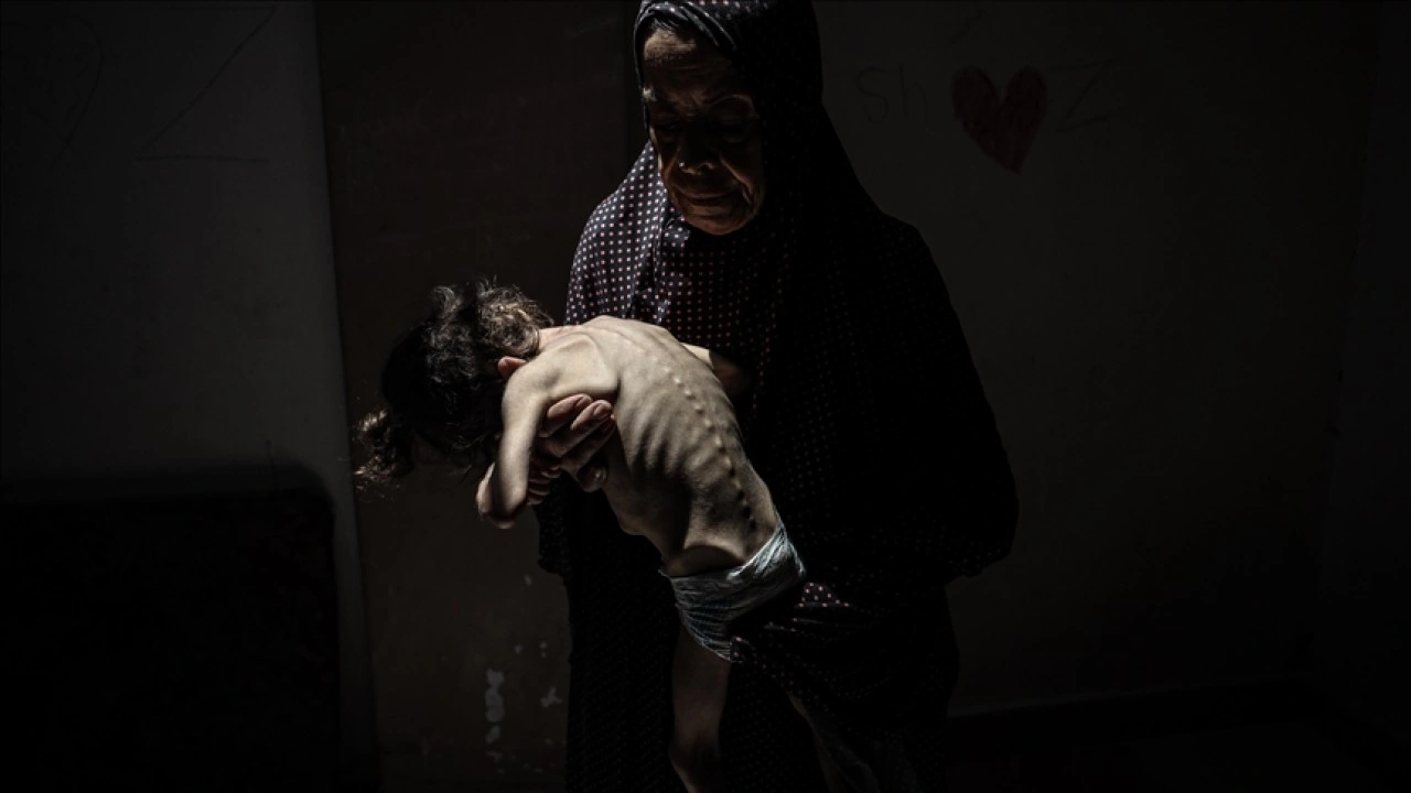 İsrail'in kıtlığı dayattığı Gazze'de son 24 saatte 4 kişi daha açlıktan hayatını kaybetti