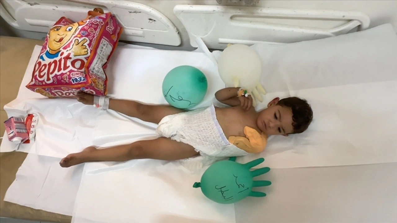 İsrail saldırısında kolunu kaybeden 4 yaşındaki Gazzeli Ahmed, hayat mücadelesi veriyor