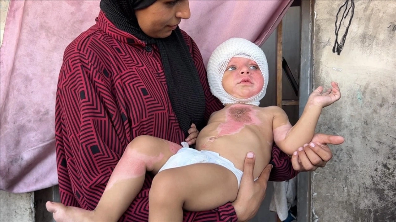İsrail saldırısından derin yanıklarla kurtulan Gazzeli bebeğin ailesi destek bekliyor