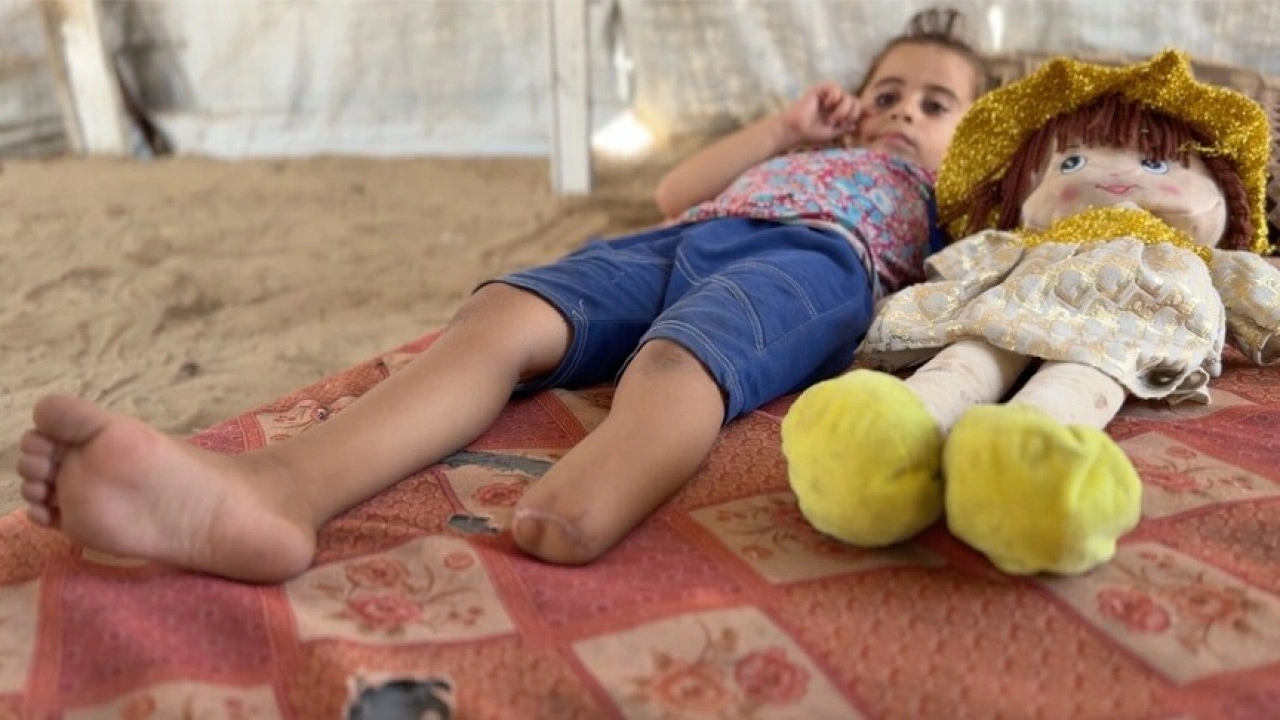 İsrail saldırısıyla hayallerini kaybeden Filistinli k&uuml;&ccedil;&uuml;k kız, kopan bacağını fotoğraflarda arıyor