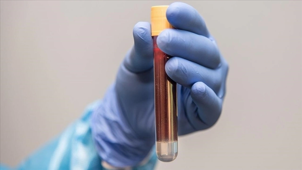 Kardeşinde prostat kanseri öyküsü olanlara 45 yaşından itibaren tarama önerisi