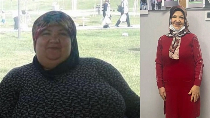 Sağlıklı yaşam için azmetti 95 kilo verdi