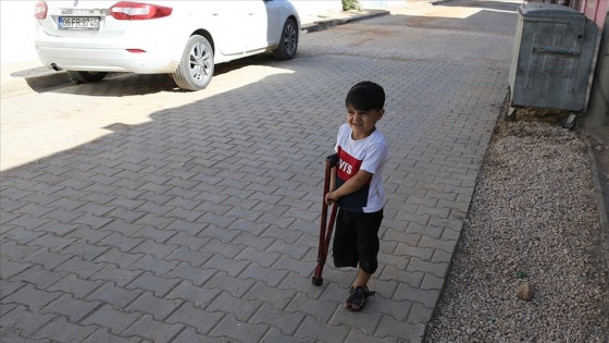 Suriyeli Muhammed protez bacakla hayata tutunacak