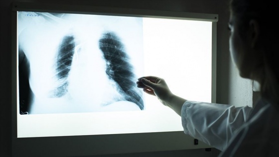 Türk araştırmacıların 'evden akciğer fonksiyon testi' teknolojisine büyük yatırım