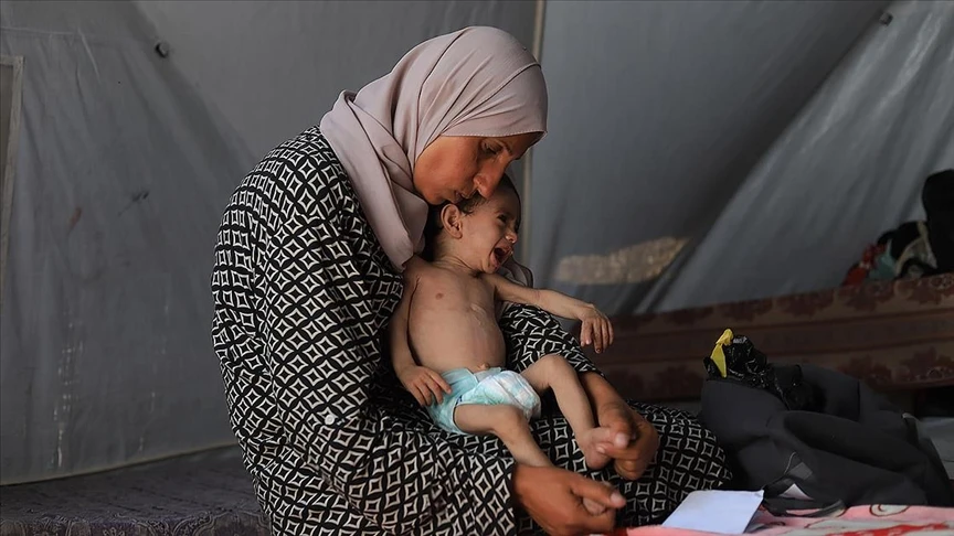 UNICEF: Haziran ayında Gazze’de 5 bin 800 çocuğa yetersiz beslenme teşhisi konuldu