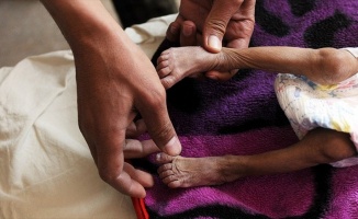 İHH Başkanı Yıldırım: Yemen&#39;de çocuklar bir deri bir kemik kalmış durumda