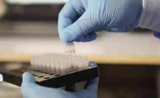 Mikrobiyologlar uyarıyor: Aşı sonrası antikor testine güvenerek tedbirleri elden bırakmayın