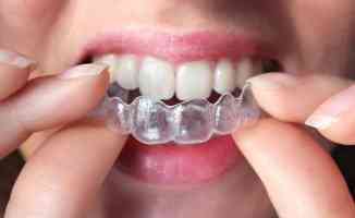 Doğru temizlenmeyen gece plakları dişlere zarar verebiliyor