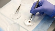 3D baskı “kırık” kalbi tamir edebilir