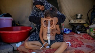 4 yaşındaki Gazzeli Necva&rsquo;nın hayata tutunması, İsrail ablukasının ardındaki bir ameliyata bağlı