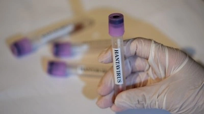 AB, hantavir&uuml;se karşı aşı ve tedavi y&ouml;ntemleri geliştiriyor