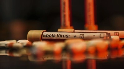 ABD'de 2026 FIFA D&uuml;nya Kupası &ouml;ncesi bazı havalimanlarında Ebola tarama merkezleri kurulacak
