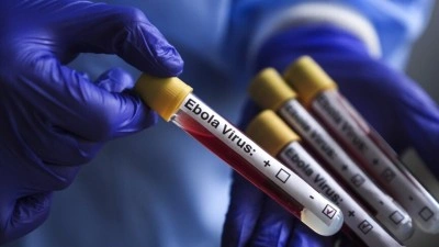 ABD, Ebola salgını nedeniyle Kongo Demokratik Cumhuriyeti'ndeki vatandaşlarının &uuml;lkeye d&ouml;n&uuml;ş&uuml;n&uuml; kısıtladı