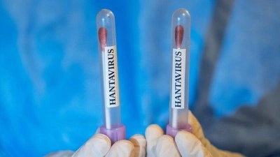 ABD, hantavir&uuml;s vakası g&ouml;r&uuml;len gemiden vatandaşlarının tahliyesi i&ccedil;in u&ccedil;ak g&ouml;nderecek