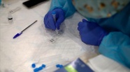 ABD'li ilaç firmasına Kovid-19 antikor testi için 'acil kullanım' yetkisi verildi