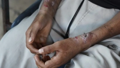 ABD'li Kongre &Uuml;yesi Khanna, İsrail hapishanesinde tutulan Filistinli &ccedil;ocuğun hikayesini anlattı