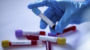 ABD&#039;nin Maryland eyaletinde 5 bebekte Kovid-19/ koronavirüs tespit edildi