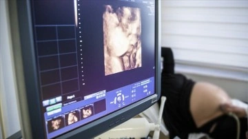 ABD'de anne karnındaki bebeğe beyin ameliyatı yapıldı