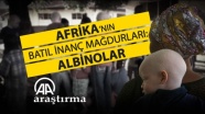 Afrika’nın batıl inanç mağdurları: Albinolar