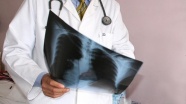 'Akciğer kanseri erkeklerde en sık görülen kanser türü'
