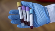 BAE'de yeni tip koronavirüs vakaları 74'e yükseldi