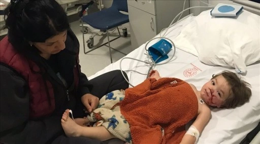 Başkentte pitbull cinsi köpeğin saldırısına uğrayan 2 çocuk yaralandı