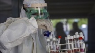 Başkentteki sanayi bölgelerinde çalışanlara Kovid-19/ koronavirüs testi yapılmaya başlandı