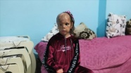 Bebekken yüzü yanan Dilara&#039;nın ailesi yardım eli uzatılmasının sevincini yaşıyor