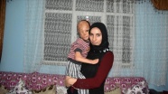 Bebekken yüzü yanan Dilara&#039;nın tedavisi Akdeniz Üniversitesinde yapılacak