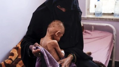 BM'den Yemen'de 18 milyondan fazla insanın şiddetli a&ccedil;lık &ccedil;ektiği uyarısı