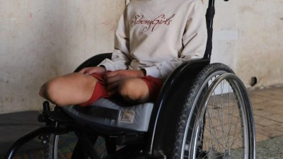 BM: Gazze'de 6 bin 600'den fazla kişi protez veya rehabilitasyon bakımına ihtiya&ccedil; duyuyor
