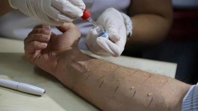 BM Gıda Standartları Komisyonu, alerji riski taşıyan gıdalara ilişkin yeni erken uyarı kılavuzunu on