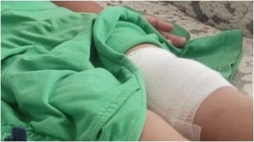 Bursa'da sahipsiz köpeğin saldırdığı çocuk bacağından yaralandı