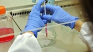 Canlı deri hücresine nano doku transferiyle tedavi imkanı